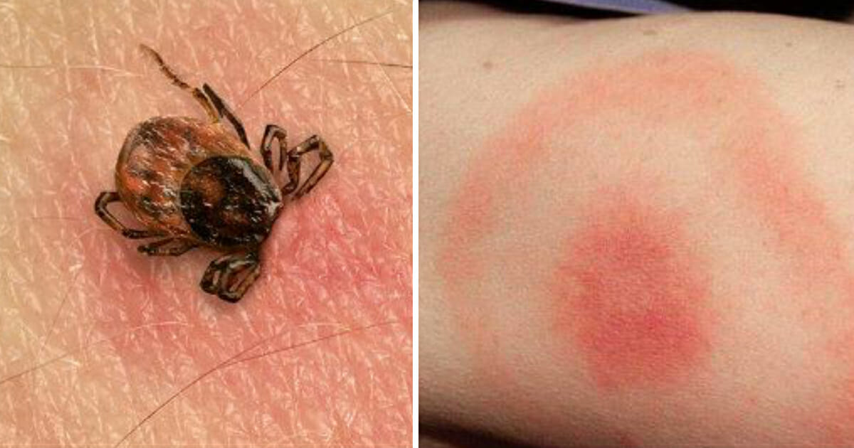 tick