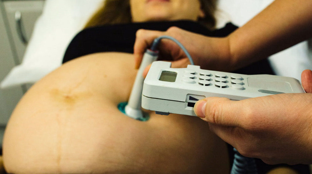 midwifeexaminingbellyofpregnantwomanwithctgscanning-pregnant