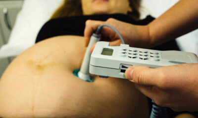 midwifeexaminingbellyofpregnantwomanwithctgscanning-pregnant